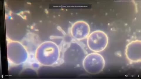 Blood of a vaccinated person: Parasites Hydra Vulgaris