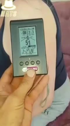 EMF test shows the vaccinated becoming transmitters.