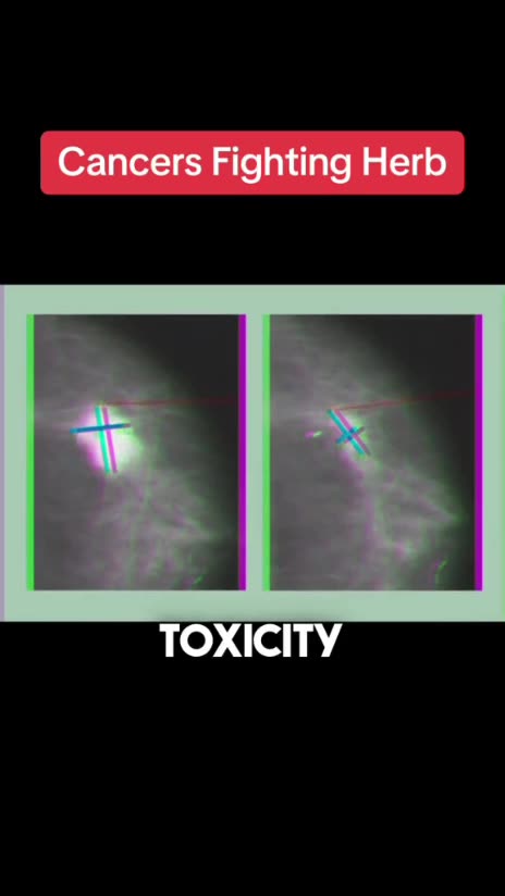 Pao Pereira is a very Powerful cancer fighting herb