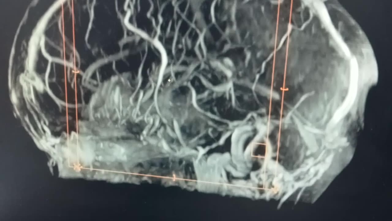 MRI Brain 🧠🧠🧠🧠🧠||Official Nazim Siddiqui