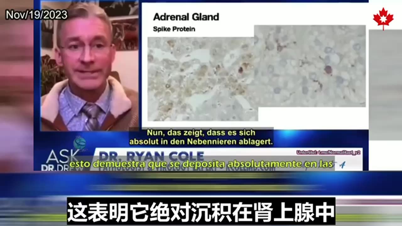 New discovery: Vaccine-induced adrenal gland dysfunction leads to heart disease 新发现：疫苗导致肾上腺功能失调引发心脏疾病