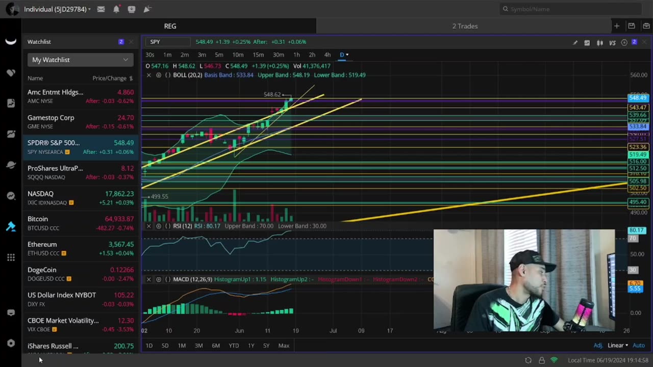 Is It Really Over For AMC & GME Stock Or Could The BIGGEST Move Still Be Coming!?