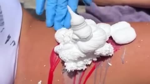 Amazing 😱 How to remove a tattoo