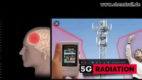 5G / 60 GHZ! Gut zuhören!