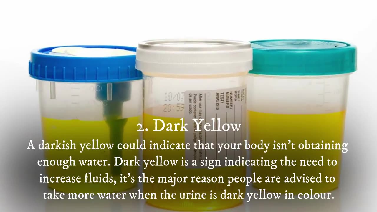 Urine Color Says A Lot About Health