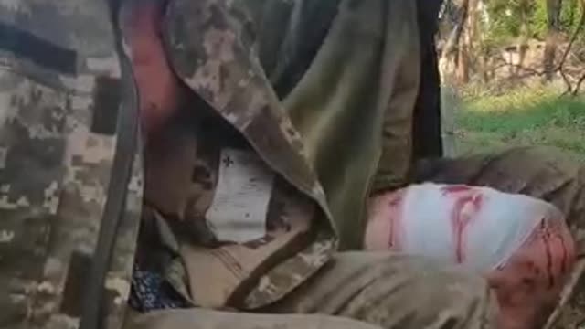 Ukraine War - Prisoners taken by Russian troops in Mirnaya Dolina