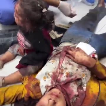 Palestinian children victims of Israeli bombing