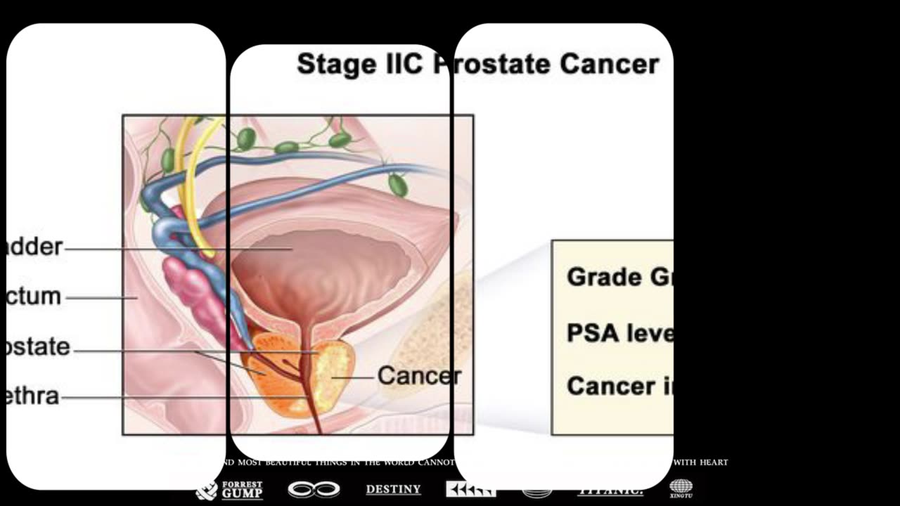 The Prostate Protocol review-How does it work?