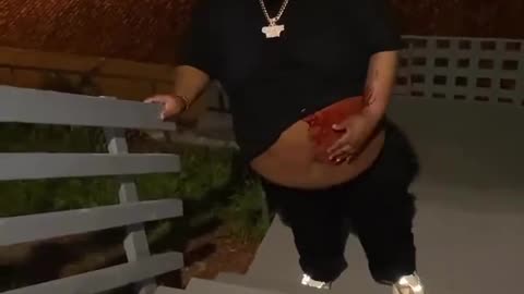 Fat Guy Who Was Shot Is Still Hungry