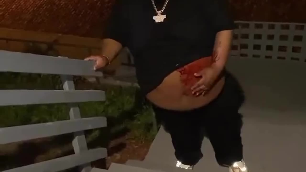 Fat Guy Who Was Shot Is Still Hungry