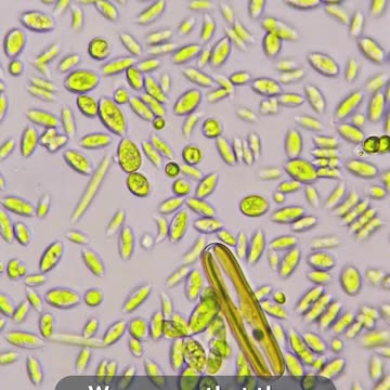 Diatoms Move, But We Don't Know How