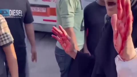 See hands of this Lady.