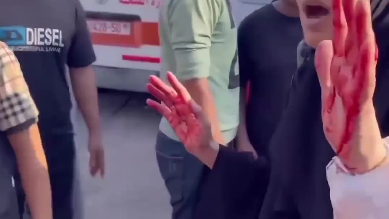 See hands of this Lady.