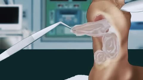 Asmr treatment animation #animation #treatment #asmr #viral