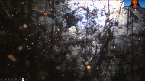 Dr Ana Maria Mihalcea - Darkfield Microscopy of Lantus Insulin Shows Self Assembly Hydrogel