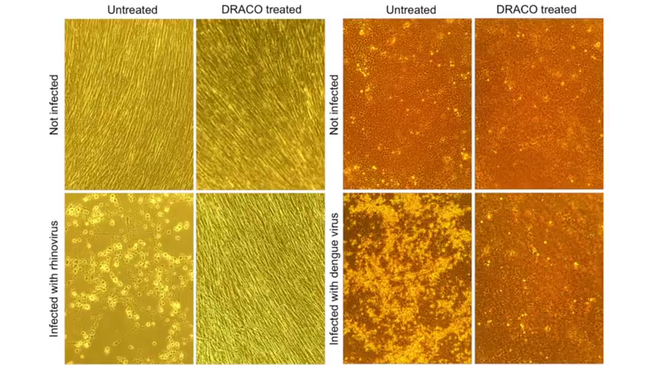 Documentary Covid19 Bio Defense Mafia