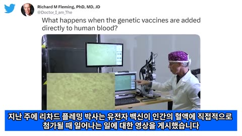 증상없는 접종자에게서 보여지는 혈전