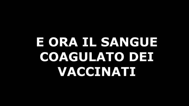 SANGUE DEI VACCINATI COAGULA APPENA PRELEVATO E OSSERVATO AL MICROSCOPIO