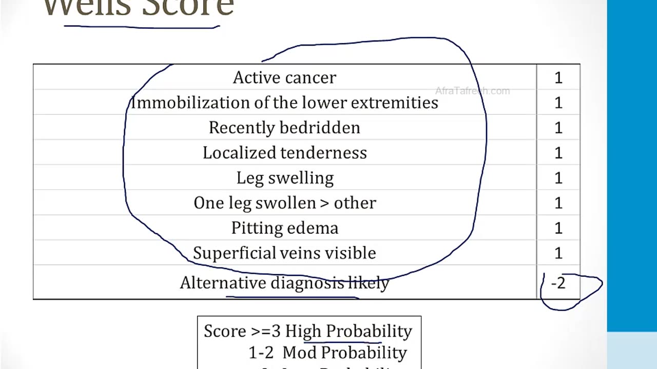 Pulmonary - 3. Other Pulmonary Topics - 8.Pulmonary Embolism