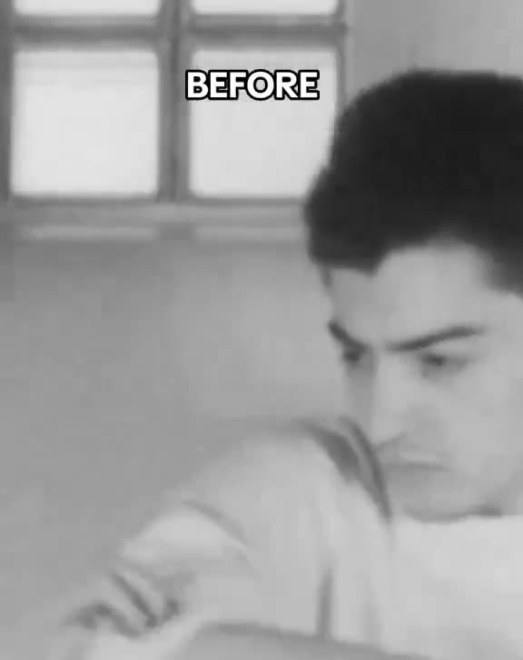 Shocking before-and-after video depicting the noticeable changes following a lobotomy.