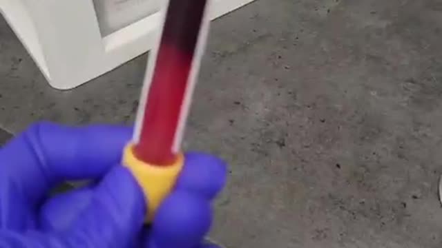דם נקרש ממחוסן 3 דקות בלבד במקום חצי שעה לא נורמלי