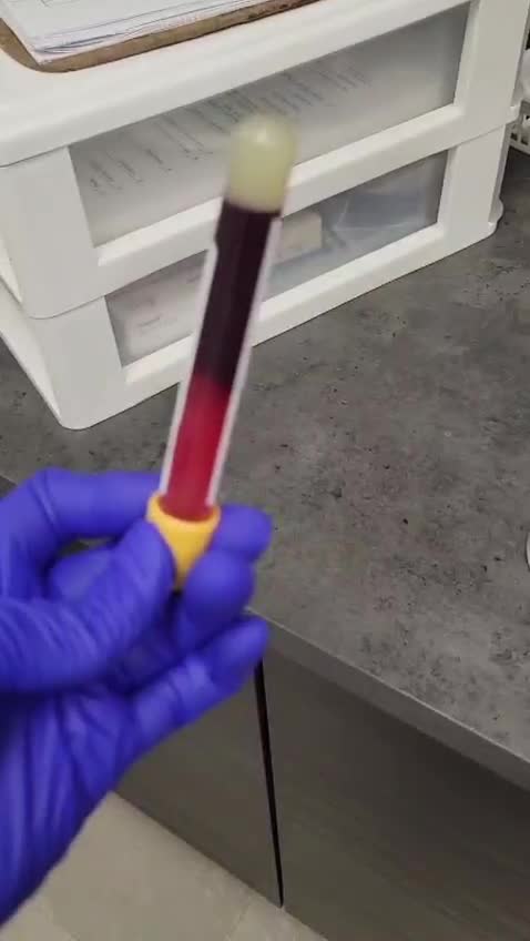 דם נקרש ממחוסן 3 דקות בלבד במקום חצי שעה לא נורמלי