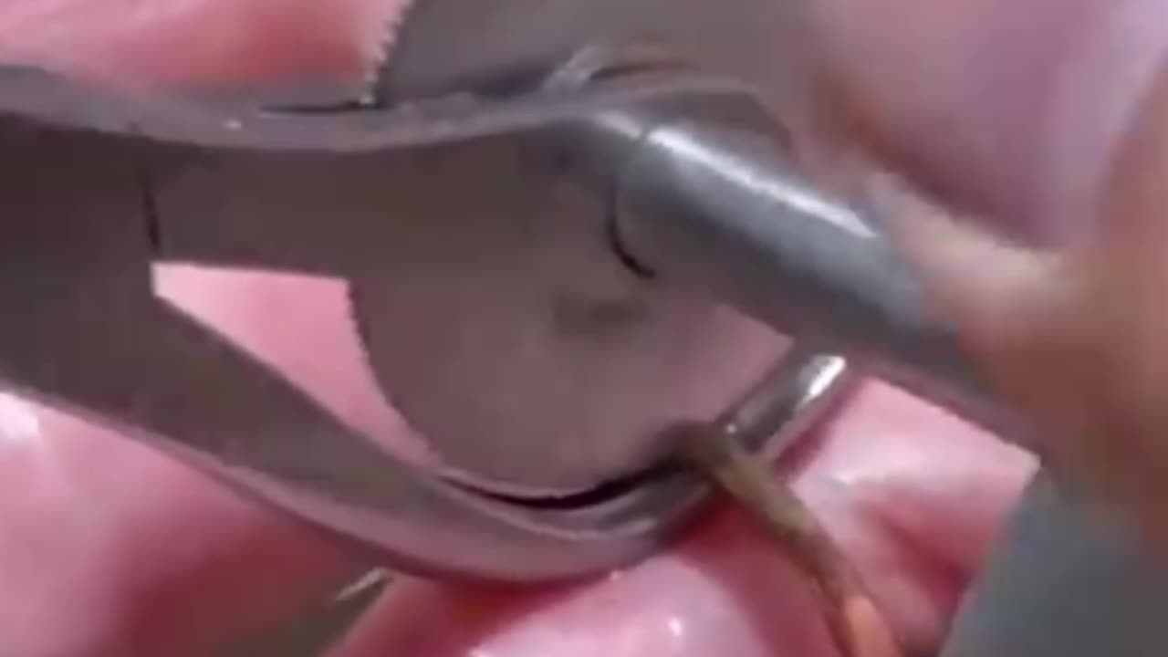 How to cut off too-tight rings