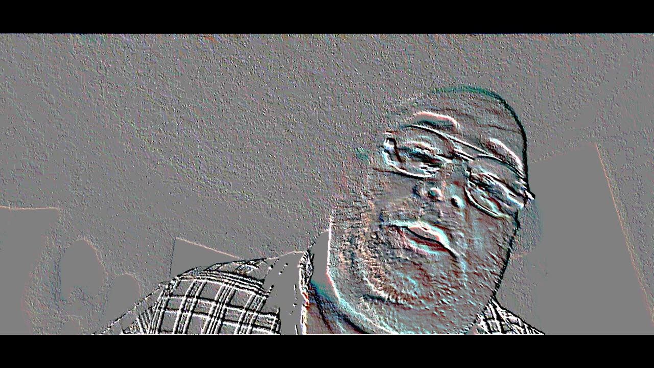 Skin colored ORB coming out of my neck.