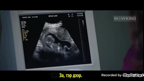 UnPlanned Abortion Scene