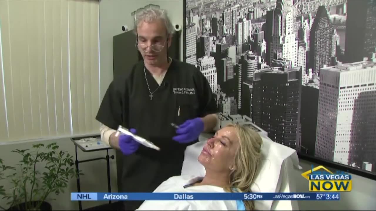 CBS Las Vegas Now - Vampire Facial