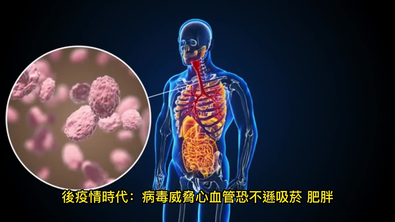 長新冠研究曝光! 心臟衰竭增72%