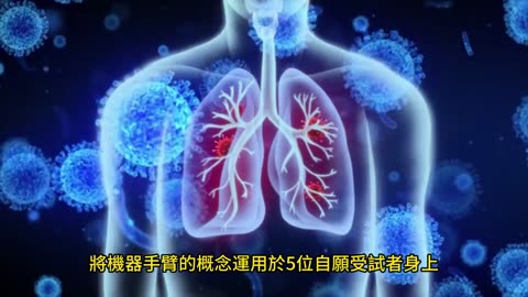 導管與機器手臂 助切除顱底腫瘤