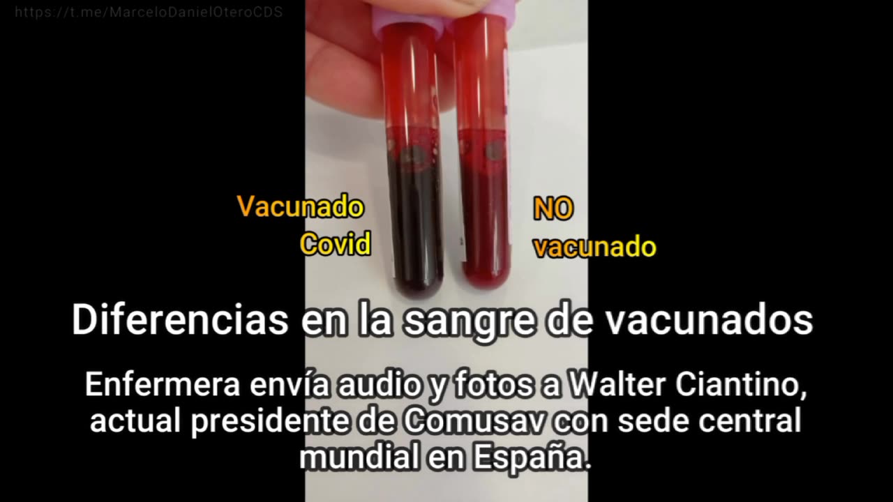 Sangre de vacunado y no vacunado.