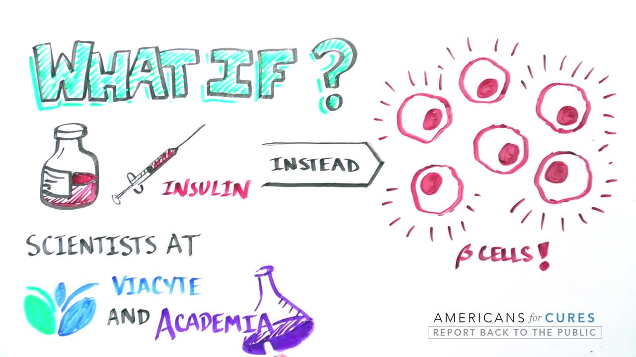 Progress_and_Promise_of_Stem_Cell_Research__Type_1_Diabetes