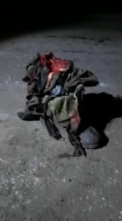 A Lost Leg - Russian Soldier