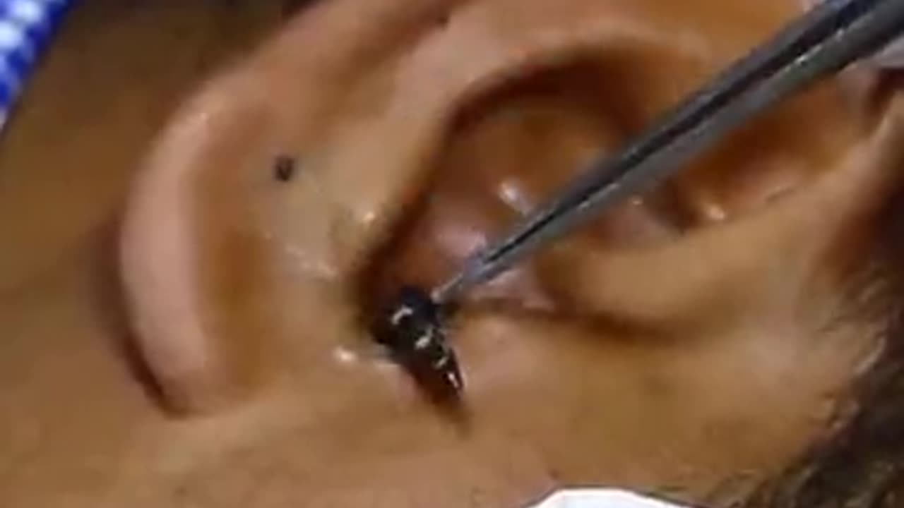 Hunted animal in the human ear hole