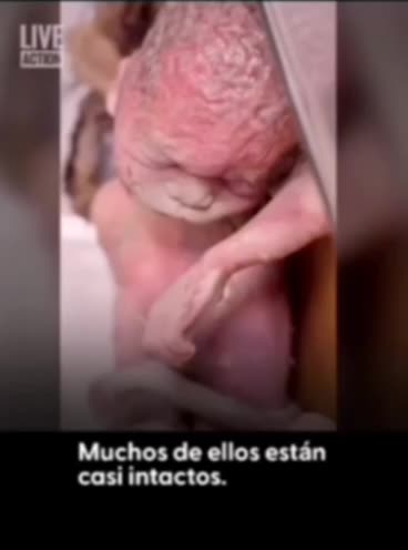 Abortos, Washington DC, EEUU. Sin palabras.