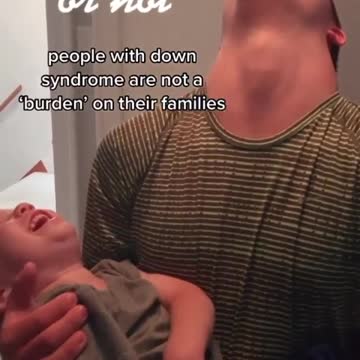 People who have Down syndrome are a joy, not a "burden" ❤️