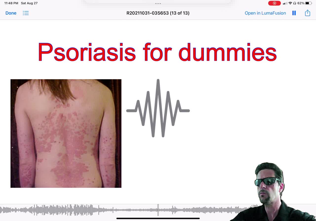 Psoriasis for dummies