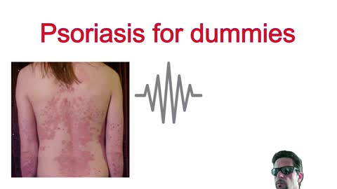 Psoriasis for dummies