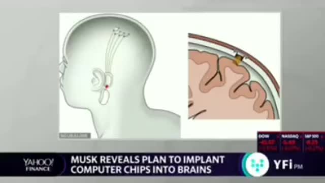 Elon Musk's公開他的“Neuralink”腦機接口技術公司 aims to wire Brain to the internet 大腦植入物(二)