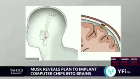 Elon Musk's公開他的“Neuralink”腦機接口技術公司 aims to wire Brain to the internet 大腦植入物（二）