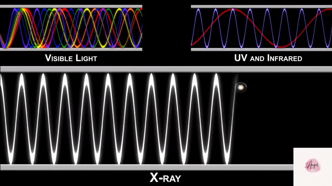 How Do X-rays Work?