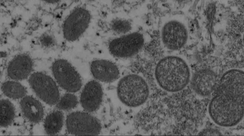 DC has highest rate of monkeypox cases per capita in the U.S. Surprised?
