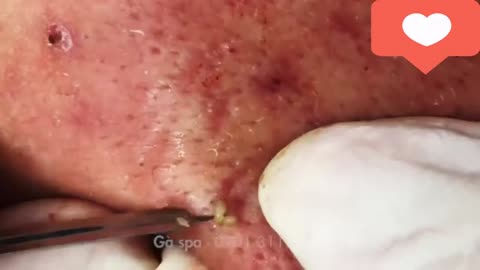 Cravos pretos