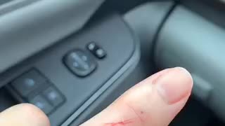Goose bit me