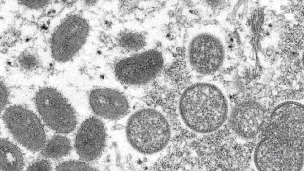 After WHO declares public health emergency, monkeypox vaccine available to exposed groups