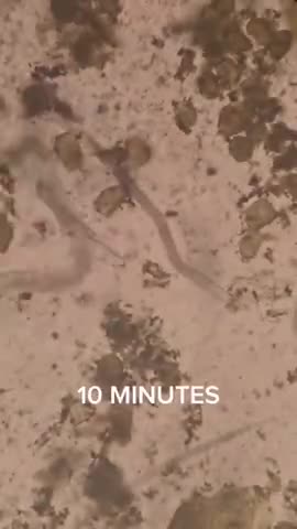 TURMERIC VS PARASITES - IT'S NO MATCH 💣