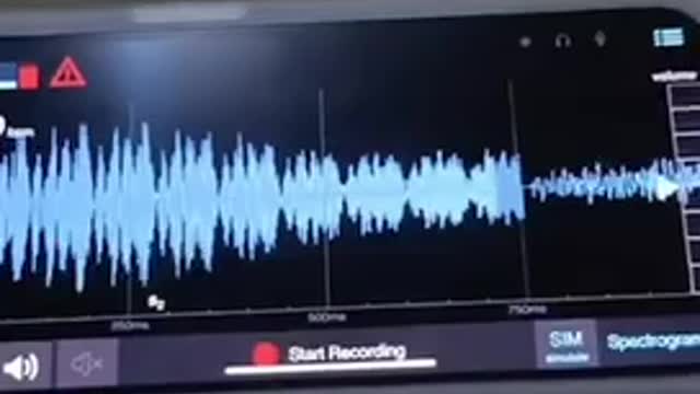 SEE RHYTHMIC PATTERN OF CONVULSIONS? NOT NATURAL. AN ELECTRONIC ATTACK BY PULSES OF ENERGY