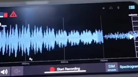 SEE RHYTHMIC PATTERN OF CONVULSIONS? NOT NATURAL. AN ELECTRONIC ATTACK BY PULSES OF ENERGY